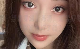 First Image